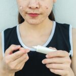 Cropped shot of Asian woman squeezing acne cream from tube for applying cream on her face for solving acne inflammation.