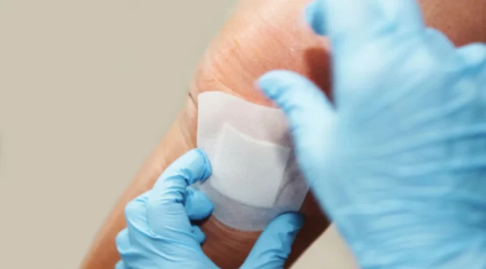 Wound infections: identification, prevention and management